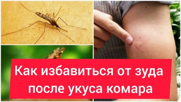 Как одолеть зуд от укусов комаров