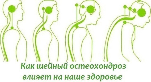 ​Эти упражнения улучшают кровоснабжение мозга, выпрямляют позвоночник, освобождает сосуды от зажимов